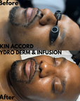 HydroFuse Facial